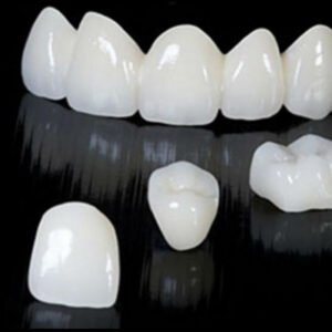 Puentes en zirconia