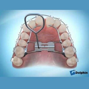 Palatar Expander
